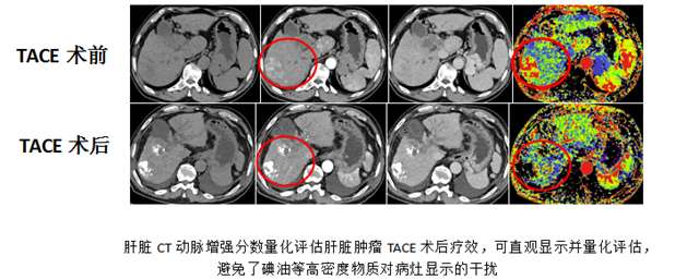 图4 (2)_副本.png