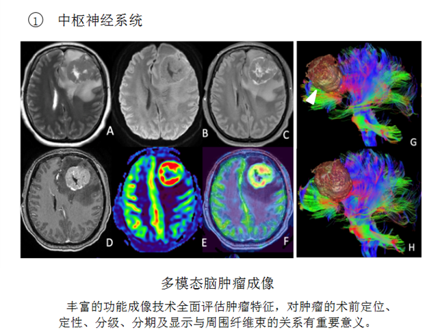 核磁3_副本.png