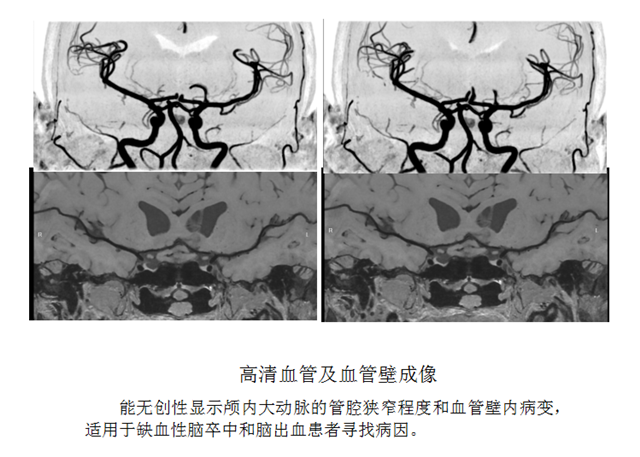 核磁4_副本.png